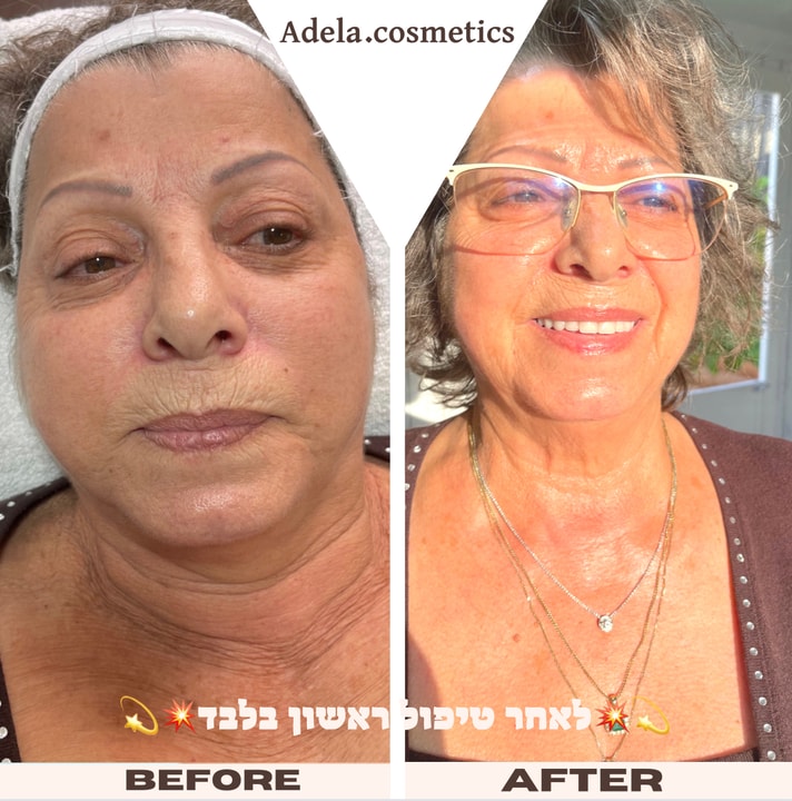 אדלה קוסמטיקס   