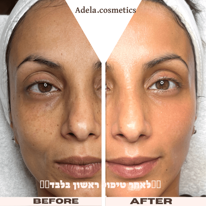 אדלה קוסמטיקס   