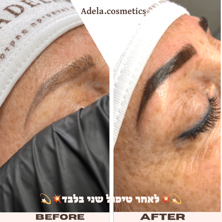 אדלה קוסמטיקס   