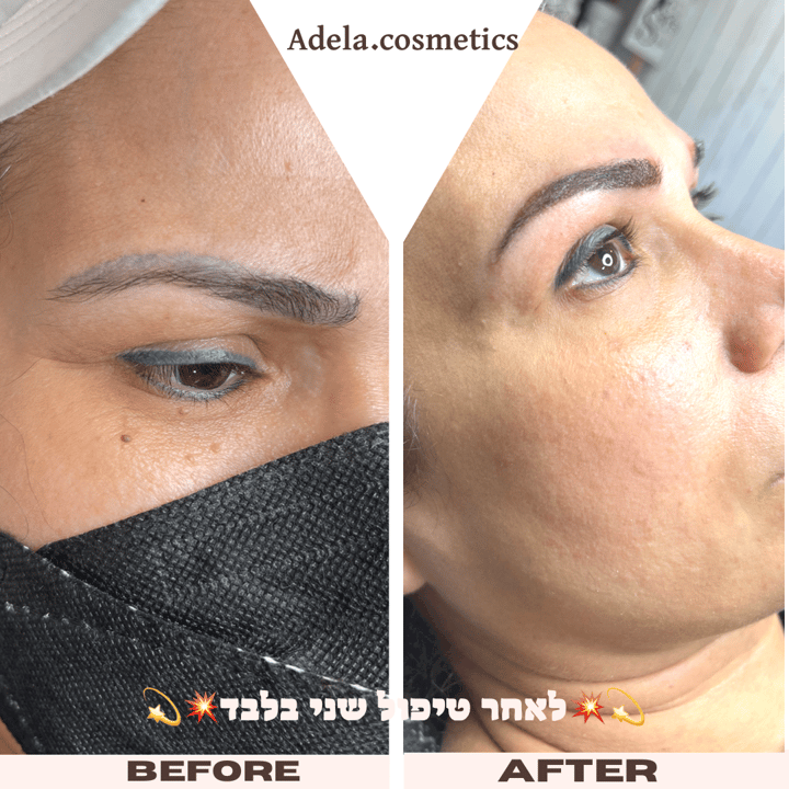 אדלה קוסמטיקס   