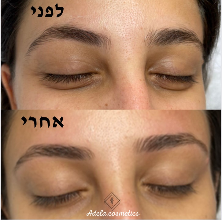 אדלה קוסמטיקס   