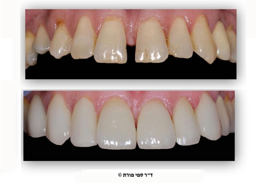 דר ספי פורת - מרפאה   