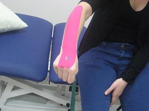 פיזיוגל טיפול בקינזיוטייפ למרפק טניס  